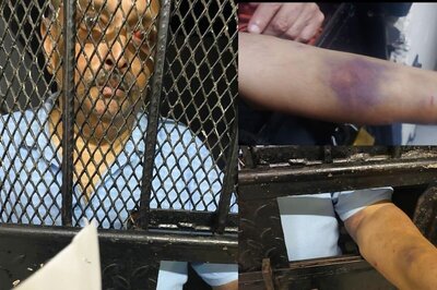 In 1st Pictures of Mehul Choksi from Dominica Jail, Diamantaire Appears With Swollen Eye, Bruised Arm
