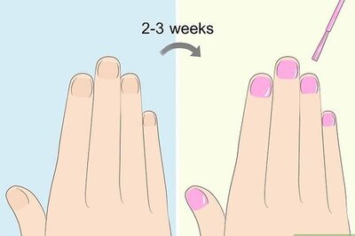 The Best Ways to Heal Damaged Nails