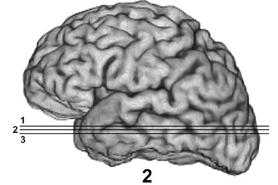 Scientists study how fear is processed in brain