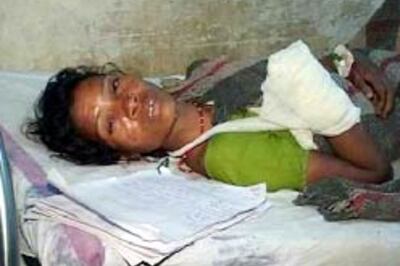 Thakurs chop off rape victim's hand