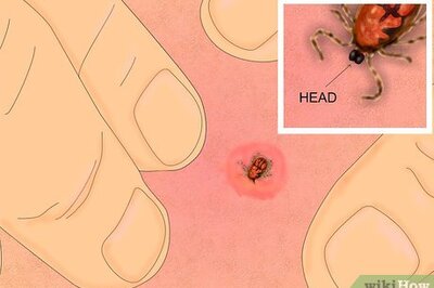 How to Remove a Tick