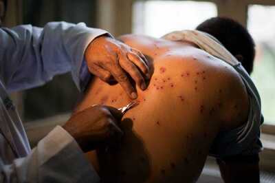 J&K High Court Dismisses Plea Seeking Ban on Use of Pellet Guns by Security Forces