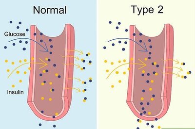 How to Treat Type 2 Diabetes