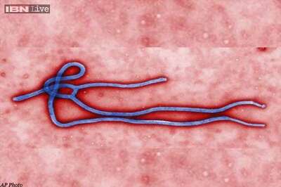2,240 Ebola cases in West Africa: UN