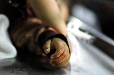 Newborn Baby Dragged Out of Operation Theatre in UP Hospital, Killed by Stray Dog