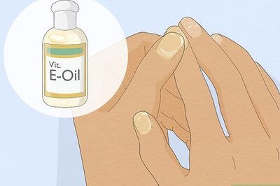 How to Get Rid of White Spots on Your Nails