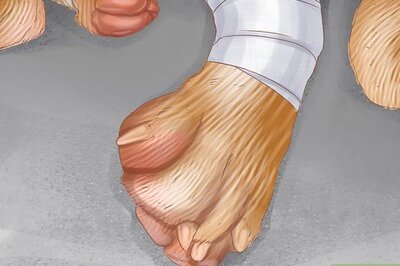 How to Care for Your Pet's Bandages