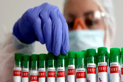 No Bird Flu Case In Bengal Now, Team Formed To Evaluate Situation: Official