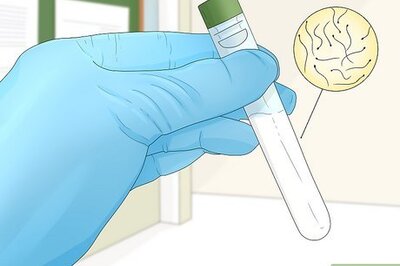 When Is Should You Stop Breeding Your Dog?