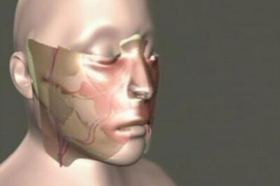 US woman gets a face swap in 22-hr surgery