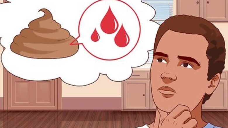 How to Diagnose and Treat Ulcerative Colitis