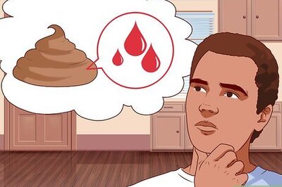 How to Diagnose and Treat Ulcerative Colitis