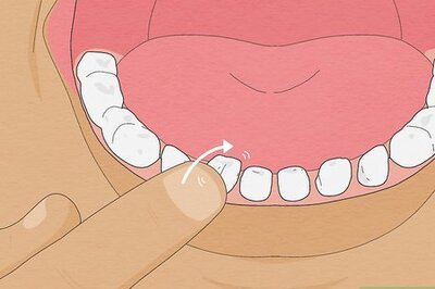 How to Pull a Loose Tooth at Home