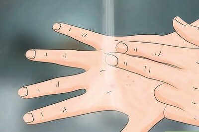 How to Reduce the Pain of Gnat Bites
