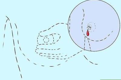 How to Soothe Sore Nipples