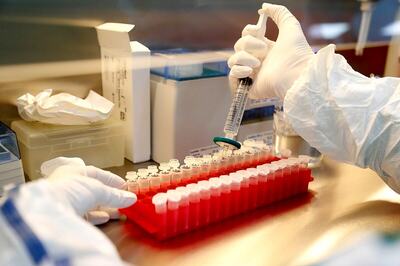 Potential Covid Vaccine, Being Developed by Queensland Univ, Could Be Available in 3rd Quarter of 2021: Australian Minister