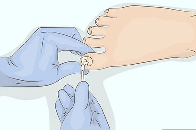 How to Cure Onycholysis