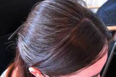 Now, homeopathy can treat premature greying