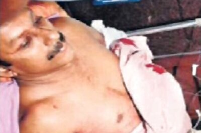 Kerala man's palm cut off in faith row; 2 held