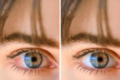 Did You Know Red Eye In Photos Is A Life Saver? Read On