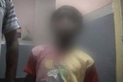 WB: 9-year-old branded with hot iron by employer
