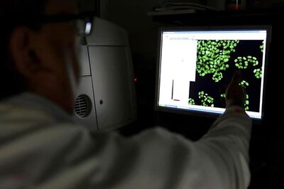 New AI system Can Diagnose Prostate Cancer Just as Good as Pathologists