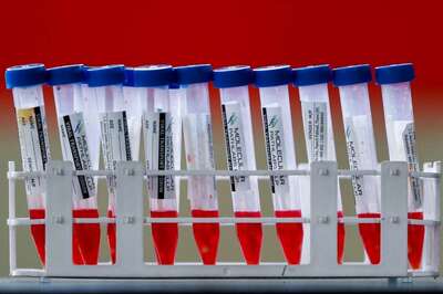 'A Hurricane': Coronavirus Storm Sends Test-makers into Overdrive