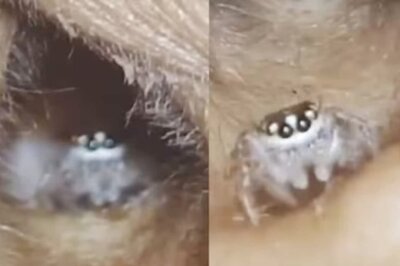 Video Of Spider Crawling Inside Woman's Ear Has Internet Trembling