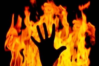 Indian Sustains Severe Burn Injuries While Trying to Save Wife in UAE