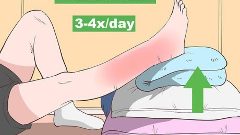 How to Reduce Leg Swelling