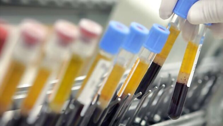 Man sues ex-wife for 'stealing his frozen sperm'