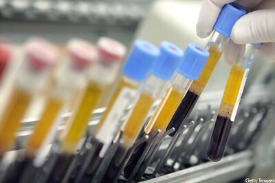 Man sues ex-wife for 'stealing his frozen sperm'