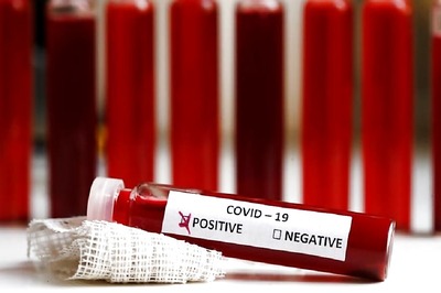 Karnataka Sets up One More Covid-19 Lab in Chikkaballapura