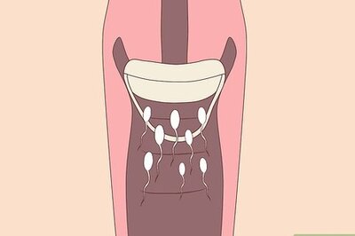 How to Use the Birth Control Sponge