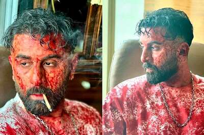 Ranbir Kapoor Smokes A Cigarette, Has Face Covered In Blood In UNSEEN Photos From Animal Shoot
