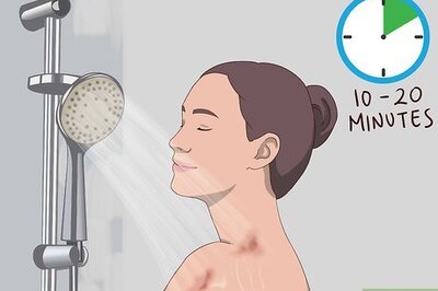 How to Heal a Tanning Bed Burn