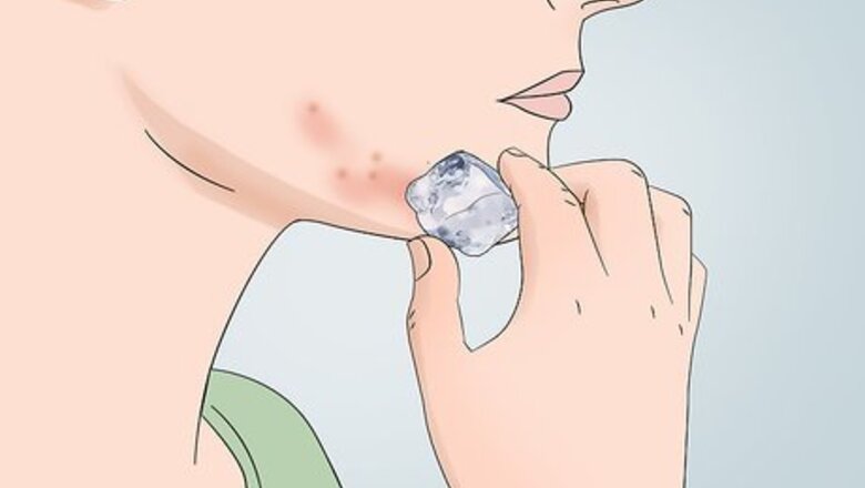 How to Cover Inflamed Pimples