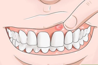 How to Reduce Gum Swelling