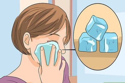 How to Prevent Eye Bags
