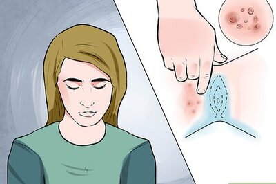 How to Recognize Genital Warts