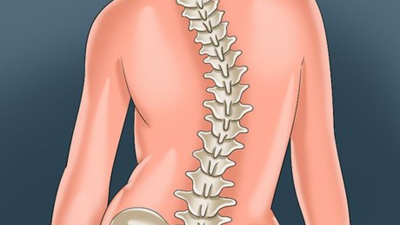 How to Deal With Scoliosis Surgery