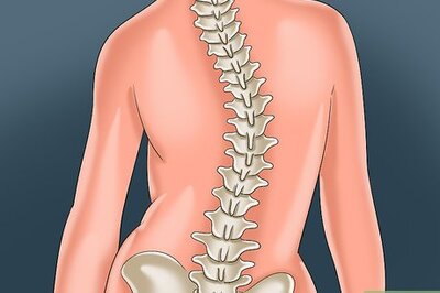 How to Deal With Scoliosis Surgery