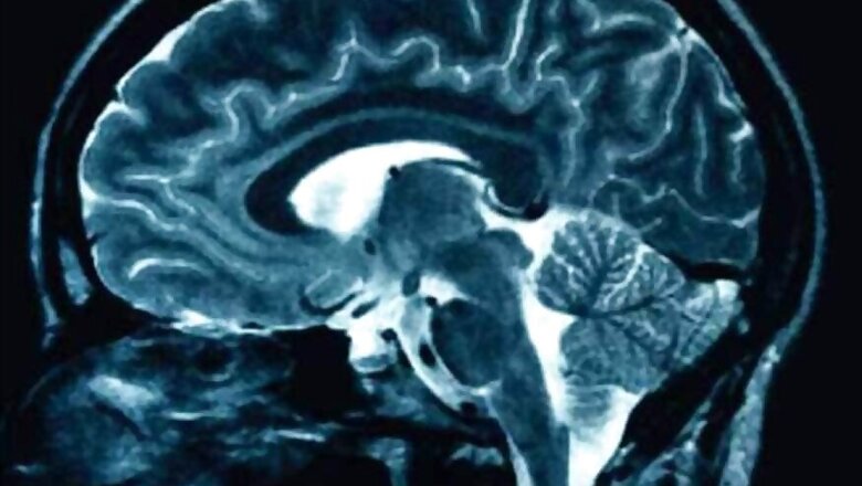 'Forgotten' Memories Can be Activated Using Magnetic Brain Stimulation