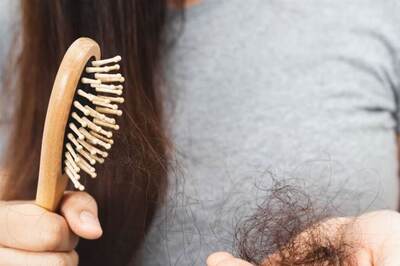 Bengaluru Techie Turns To RO Water To Prevent Hair Loss. Internet Has Other Solutions Too