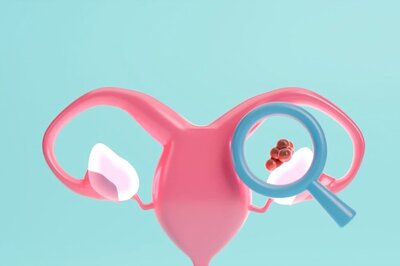 Ovarian Cancer Diagnosis: What You Need to Know and Do Next