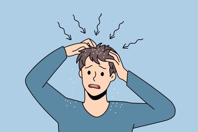 What Is Scalp Acne And How To Treat It Right