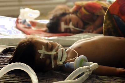 5 More Patients Die, Assam Encephalitis Toll Rises to 76