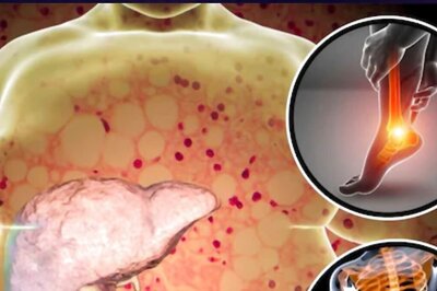 Experiencing A Lack Of Appetite And A Bloated Stomach? It May Be A Sign Of Liver Disease