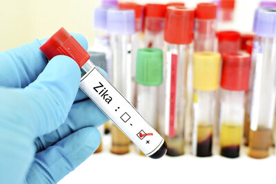 Aedes Mosquito Responsible for Zika Cases in 2016 at Ahmedabad