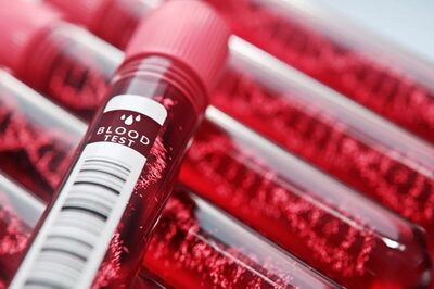 Blood Donation Day 2024: Finding Different Blood Conditions For Better Blood Donation